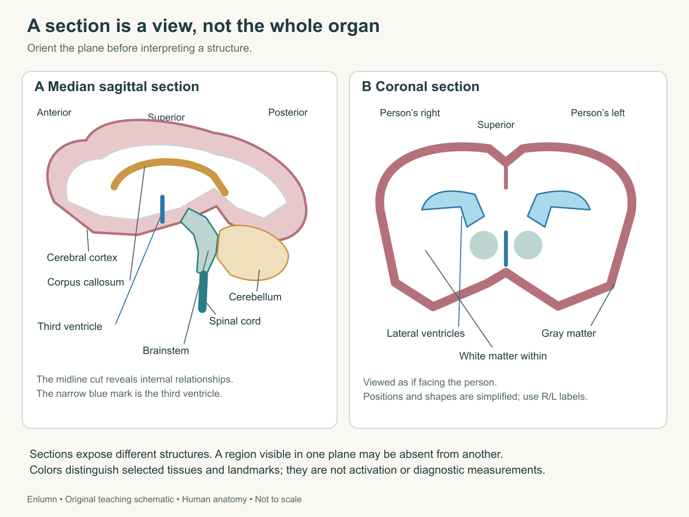 Two simplified human brain sections show anterior, posterior, superior and right/left orientation; selected cortex, white matter, ventricles, brainstem and cerebellum are distinguished.